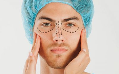 Rinoplastia en Valladolid: todo lo que necesitas saber antes de tu cirugía de nariz