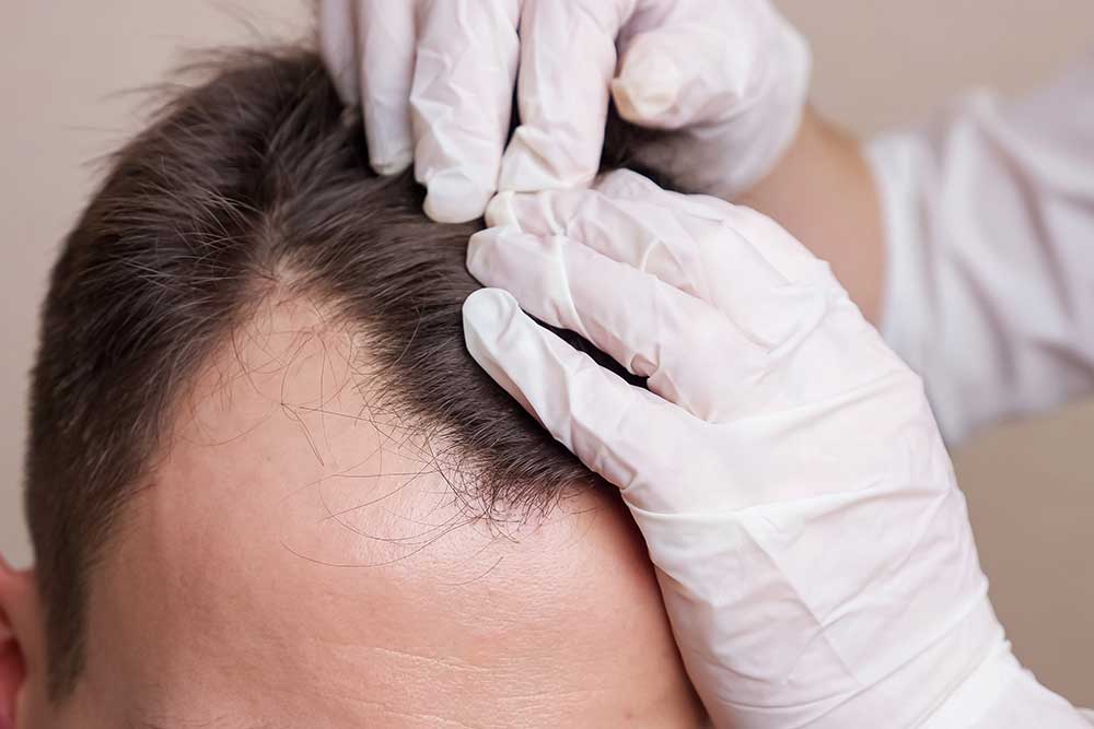 Medicación tópica y oral. Tricología. Lomás