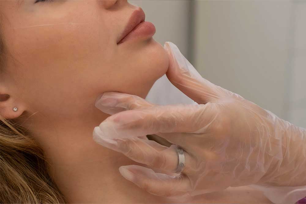 Bichectomía. Cirugía plástica facial