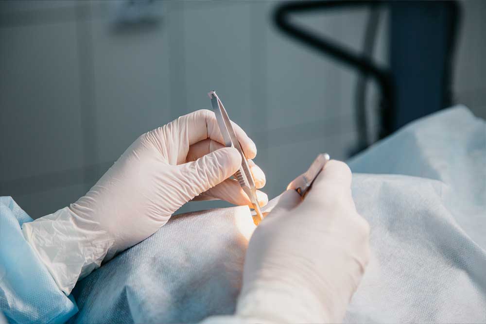 Cirugía dermatológica. Dermatología . Lomás